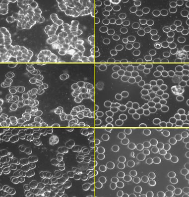 earthing_3_398 earthing_3_398