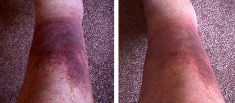 earthing_2_483 earthing_2_483